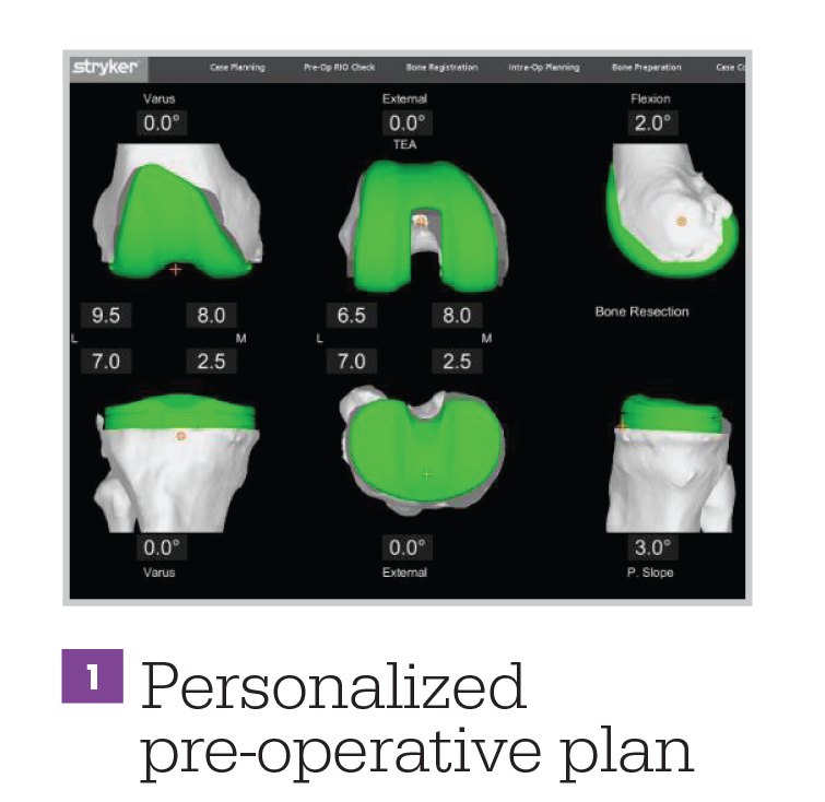 Personalized Operative Plan